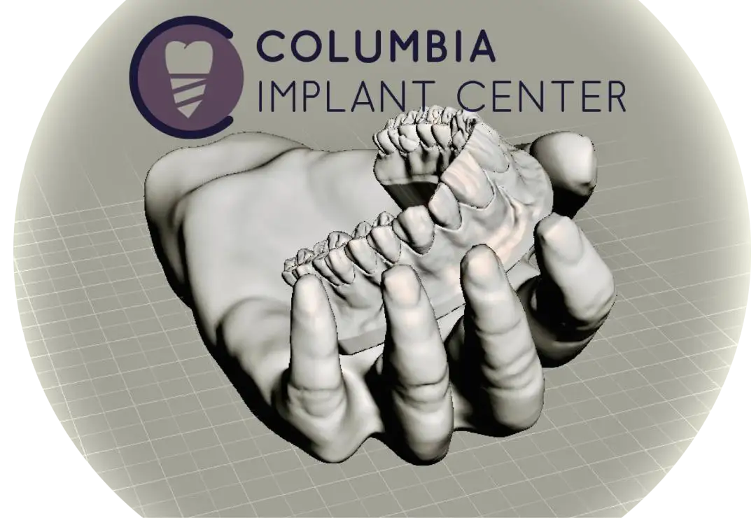 Columbia Implant Center logo hovering about a 3-d rendering of a hand holding a set of manufactured teeth. 